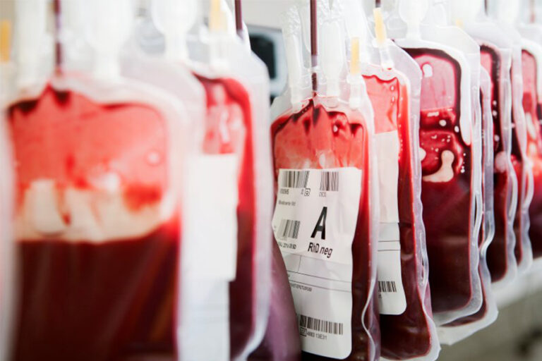 Overcoming blood shortages to reduce maternal bleeding fatalities in sub-Saharan Africa