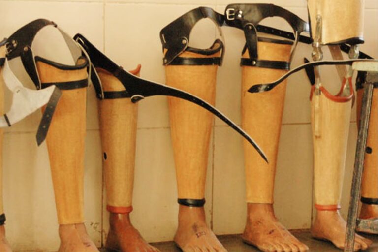 Jaipur Foot: Transforming lives in Ethiopia through prosthetic innovation